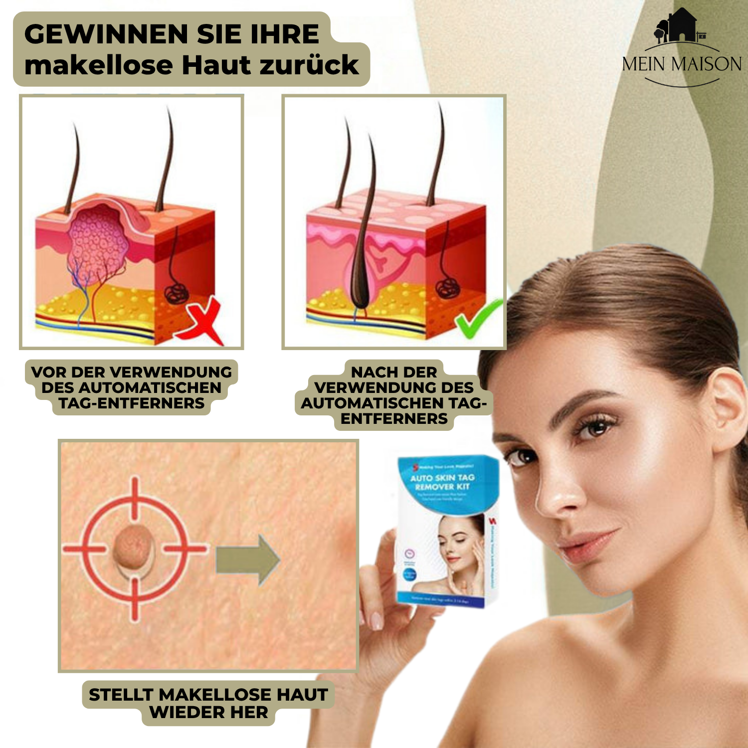 "DermaLinx Warzenentferner für schmerzfreie, effektive Behandlung von Warzen, glatte Haut ohne OP, ideal für sensible Bereich