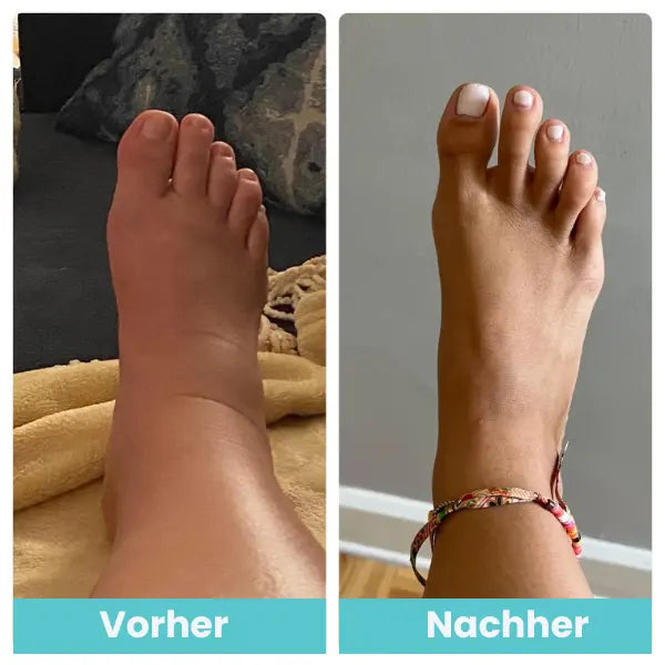 "EMS Fußmassager mit NMES-Technologie, ovales Design, schwarz, für Schmerzlinderung, Durchblutungsförderung, Wohlbefinden."