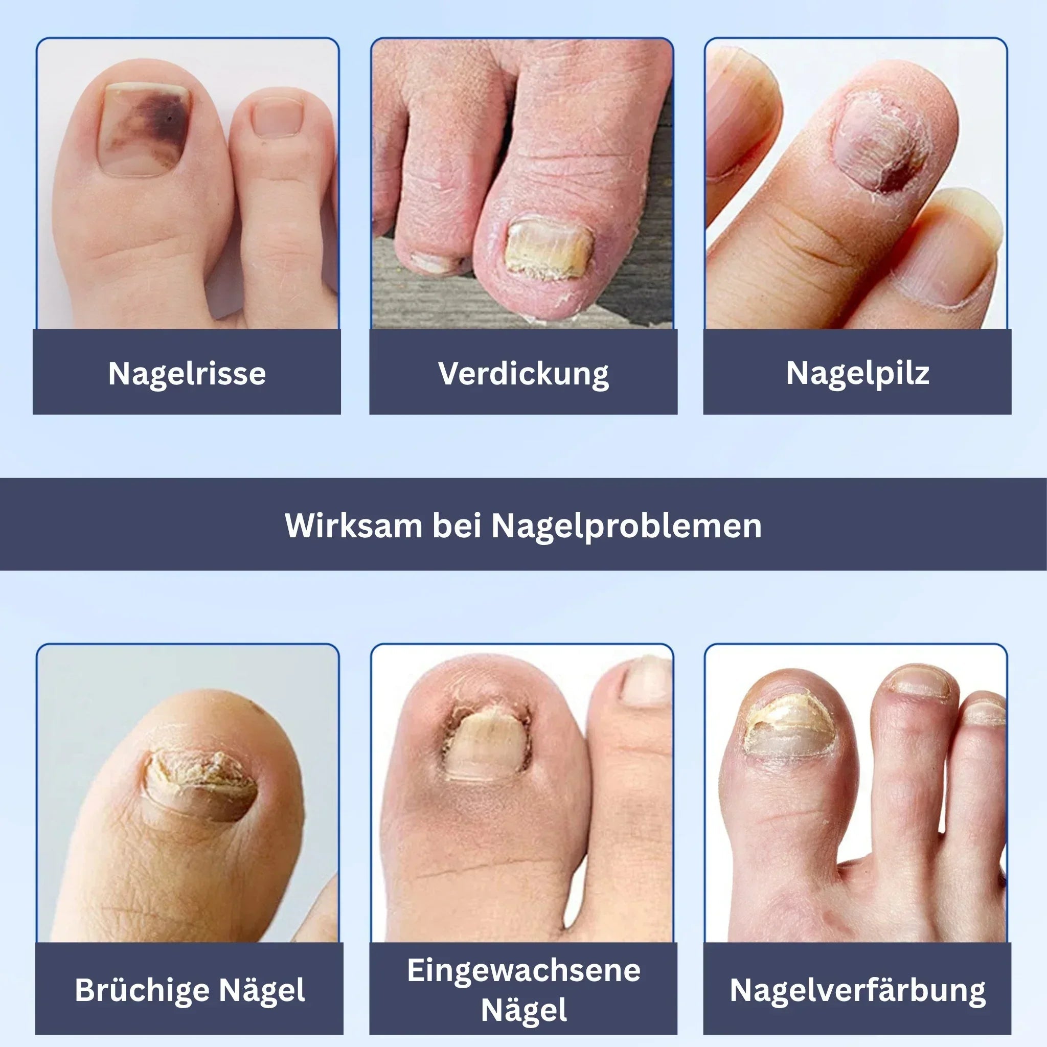 "Feuchtigkeitsspendende Nagelpflege Hydrogel-Patches, transparent, auf Nägeln angewendet für intensive Pflege und Glanz"