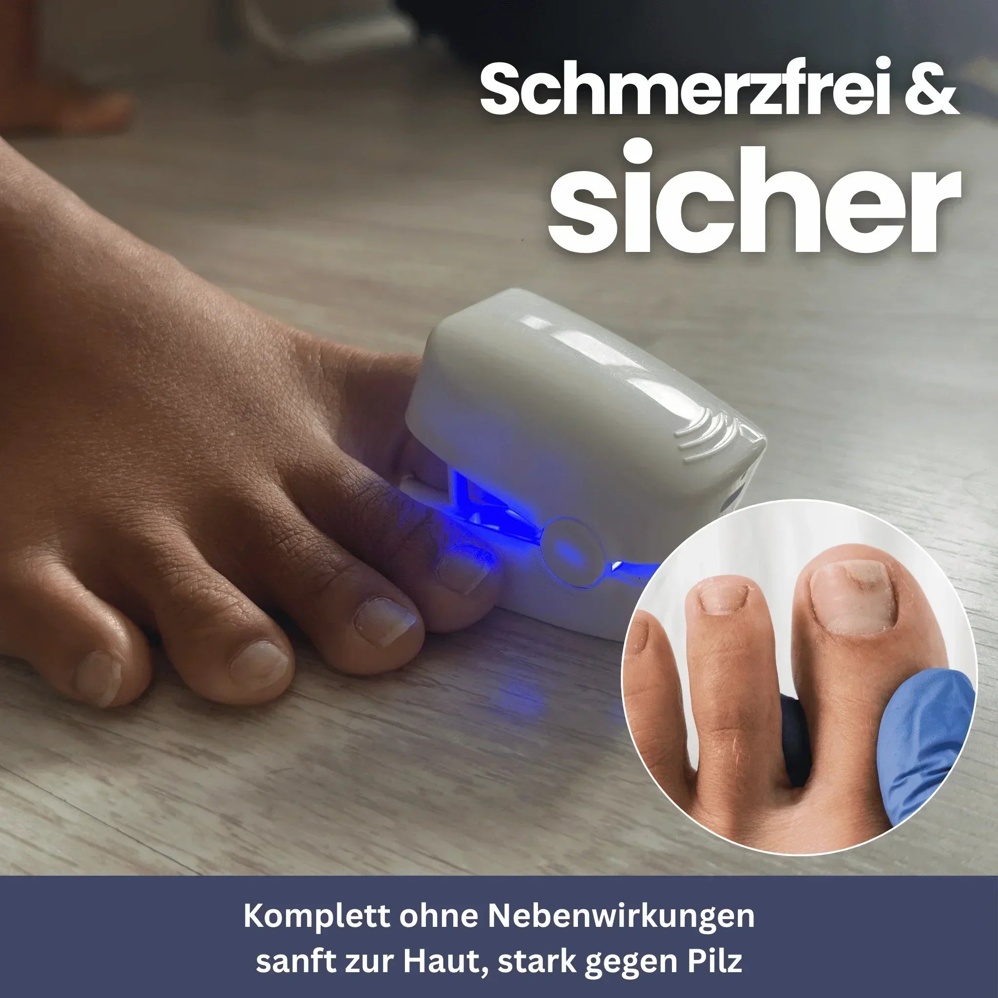 "Kompaktes NailClip Nagelpilztherapie-Gerät vorne, ideal für effektive Nagelbehandlung mit Phototherapie-Technologie."