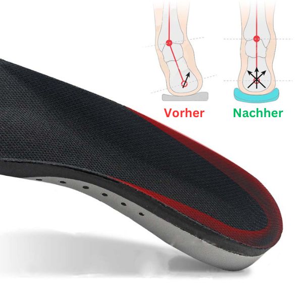 "Orthopädische Einlegesohlen, strukturierte Oberfläche, blaue Dämpfungsschicht, Fußkomforthilfe, ideal für Sportler."