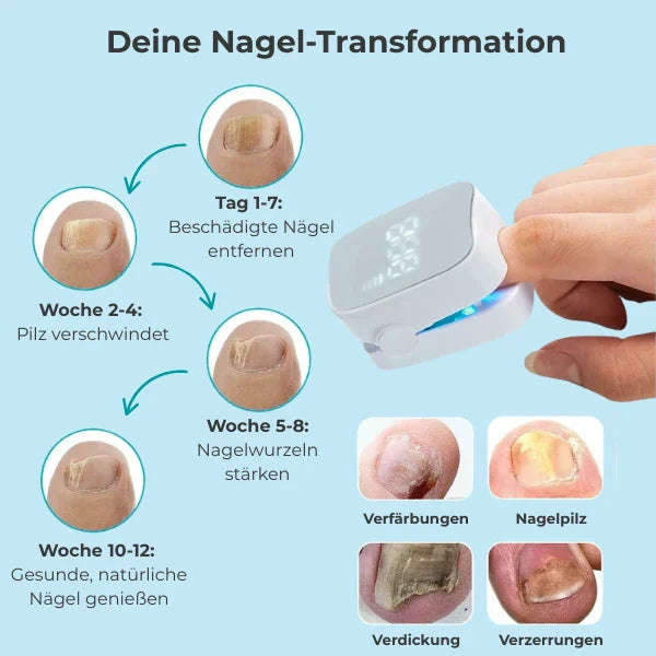 "RevitaNail Nagelpilz Therapie, klare Flüssigkeit, hellblaues Etikett, effektive Nagelpflege, fördert gesundes Wachstum"