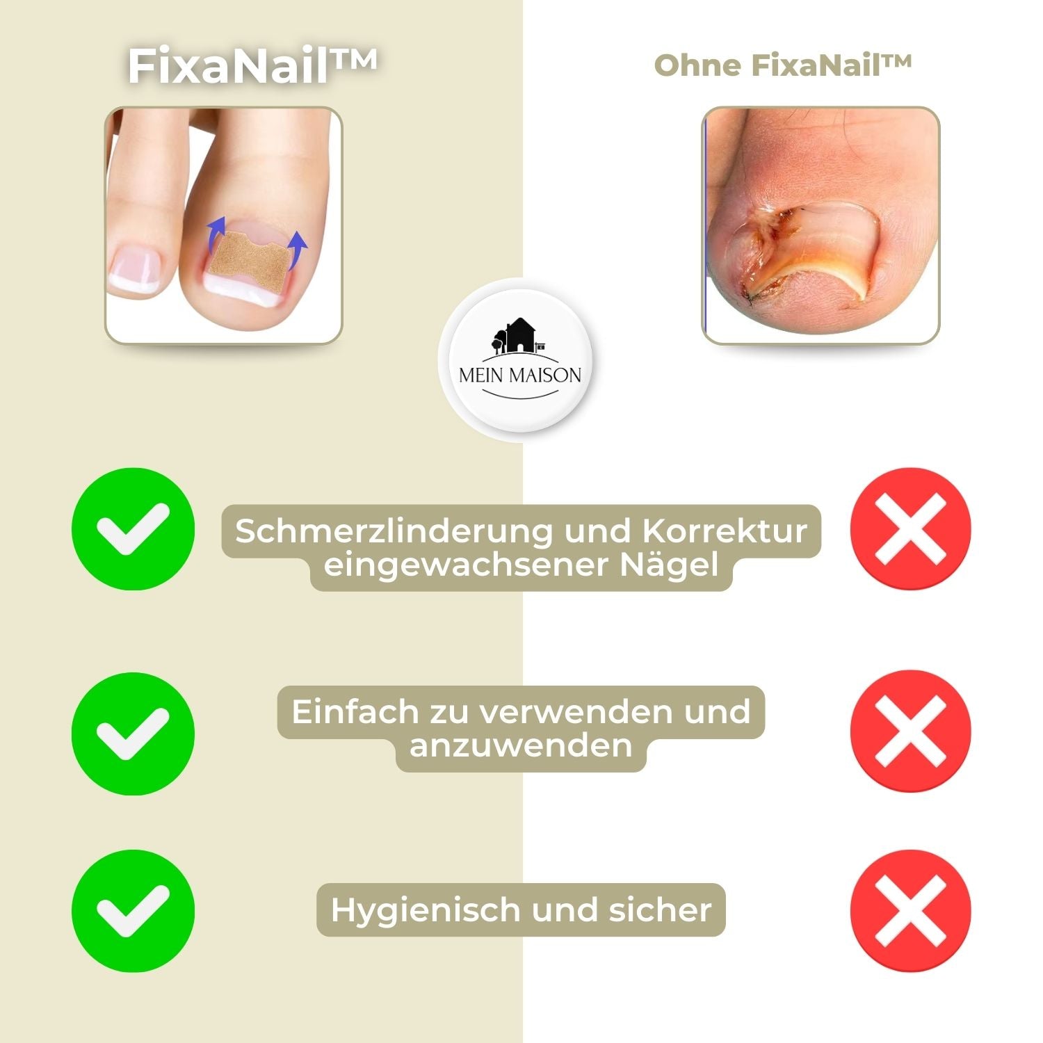 "Sofortige Nagelkorrektur: Transparent, diskret auf Nägel anwendbar, bietet Linderung bei eingewachsenen und deformierten Näg