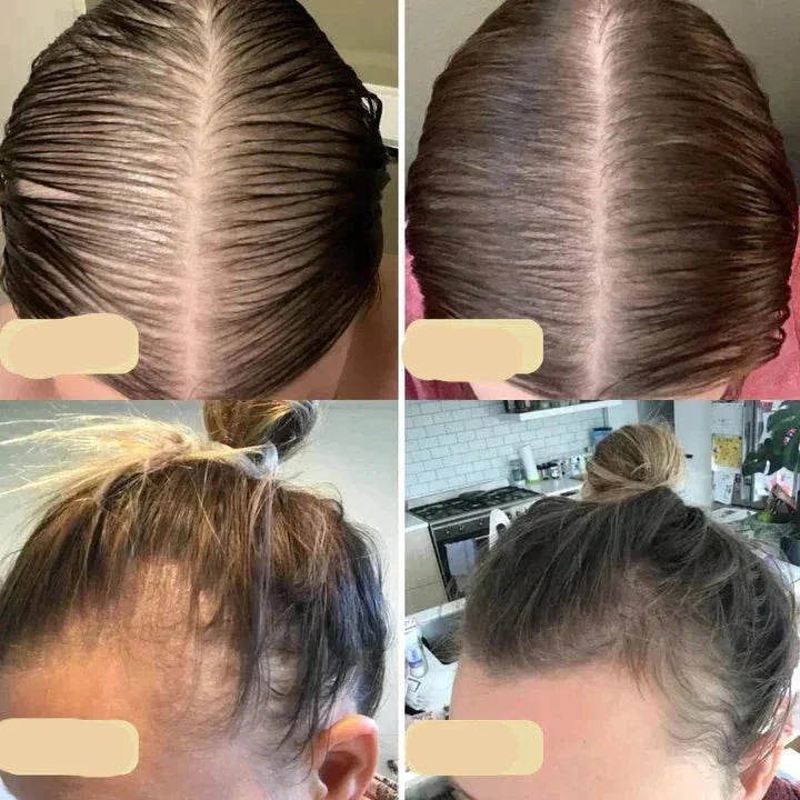Flaske med naturlig hårvekstolje for kvinner. Spesialutviklet for å fremme hårvekst og hodebunnens helse.
