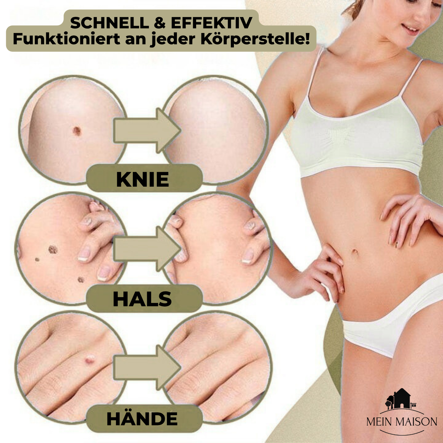"DermaLinx Warzenentferner für schmerzfreie, effektive Behandlung von Warzen, glatte Haut ohne OP, ideal für sensible Bereich