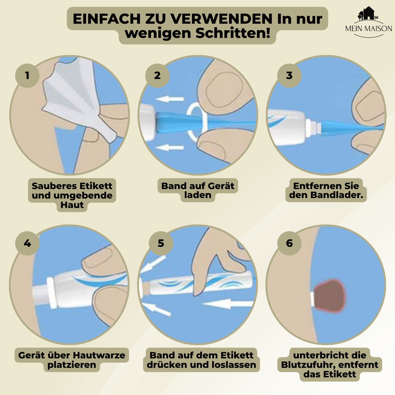 "DermaLinx Warzenentferner für schmerzfreie, effektive Behandlung von Warzen, glatte Haut ohne OP, ideal für sensible Bereich