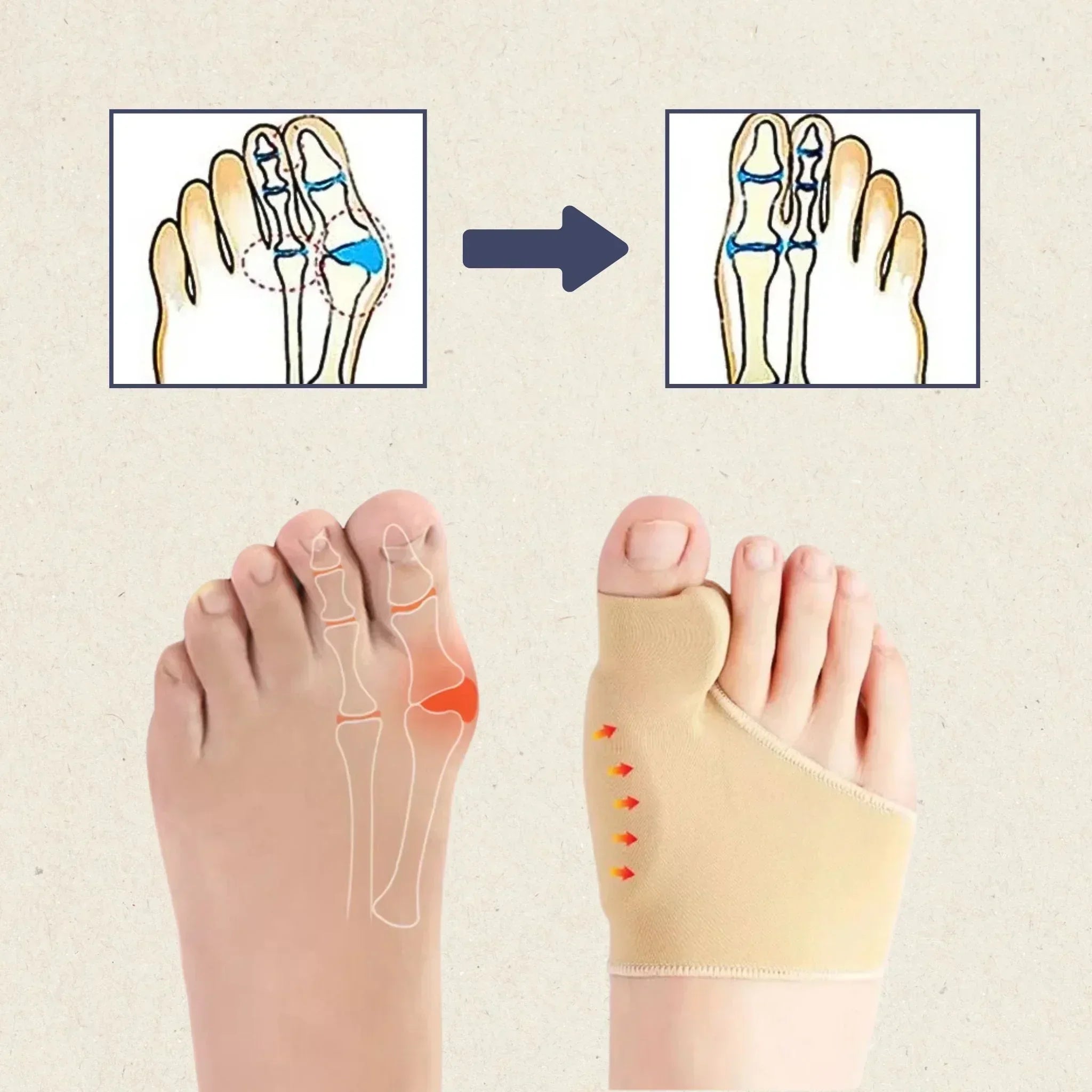 "Ergonomische HalluxFit Bandage für Hallux-Valgus, graues Accessoire, bietet Halt und Bewegungsfreiheit"