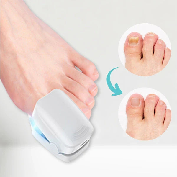 RevitaNail produktbilde