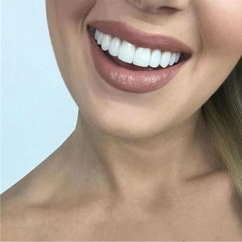Gjenbrukbar tannfiner for smileforbedring. Enkel kosmetisk tannrestaurering for hvitt smil uten tannlegebesøk.