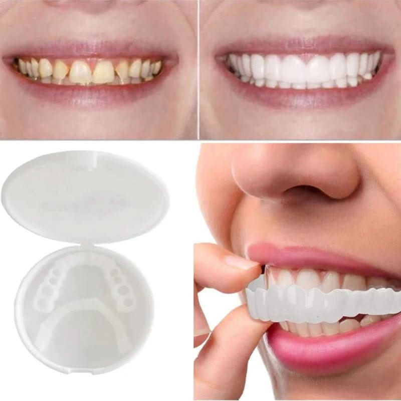Unisex tannrestaurering for et strålende smil. Enkel påføring av gjenbrukbar tannfiner for hvitt smil.