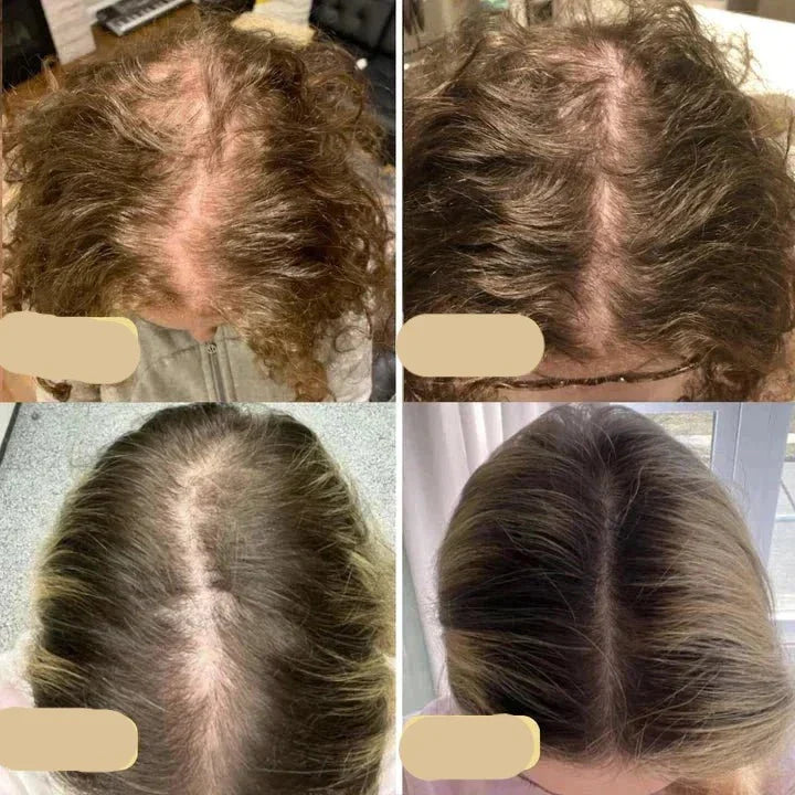Nærende hårvekstolje for kvinner. Gir hodebunnen fuktighet, reduserer hårtap og fremmer naturlig styrke.