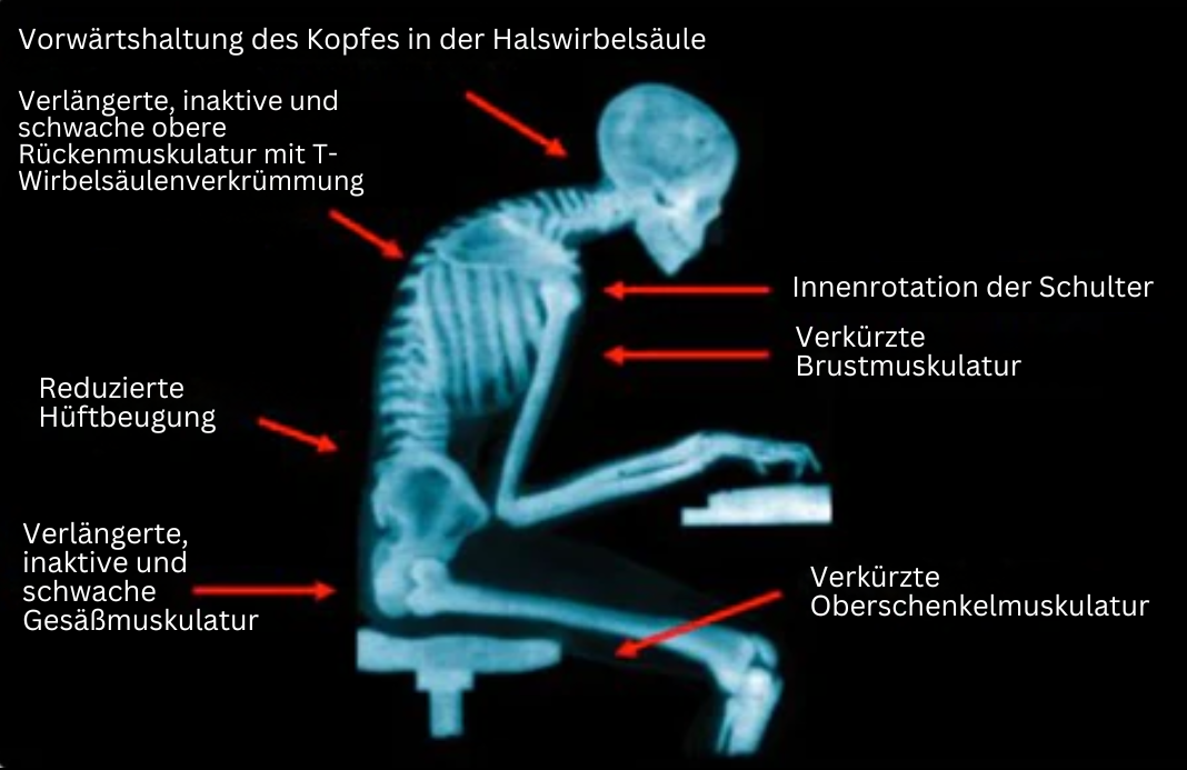 Holdningsbandasje med EMS-teknologi for å styrke ryggmuskulatur og fremme god rygghelse hos voksne.