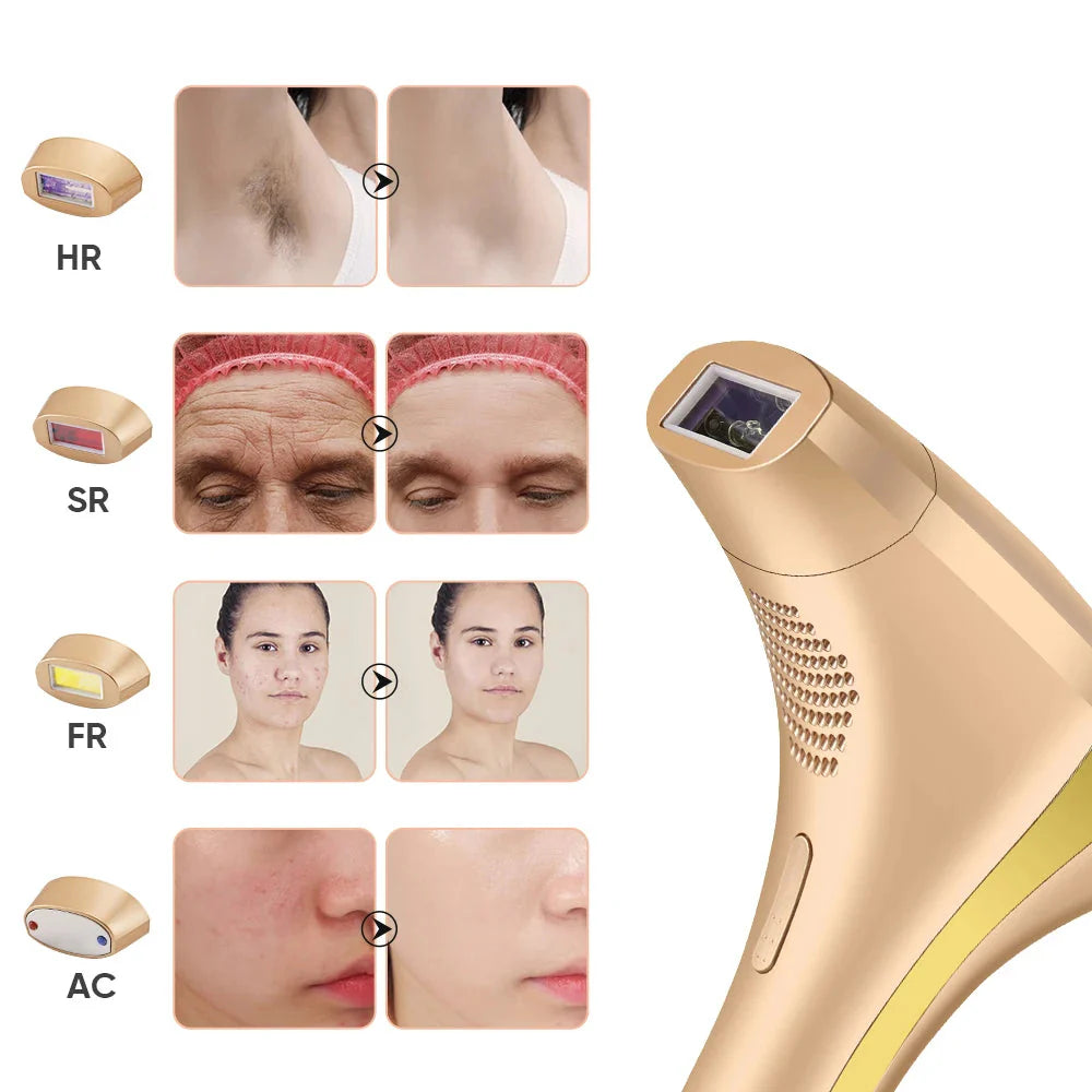 Kvinne bruker skånsom laser epilator med IPL teknologi for effektiv hårfjerning på benet. Ideell for hjemmebruk.